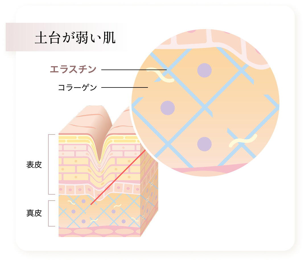 土台が弱い肌